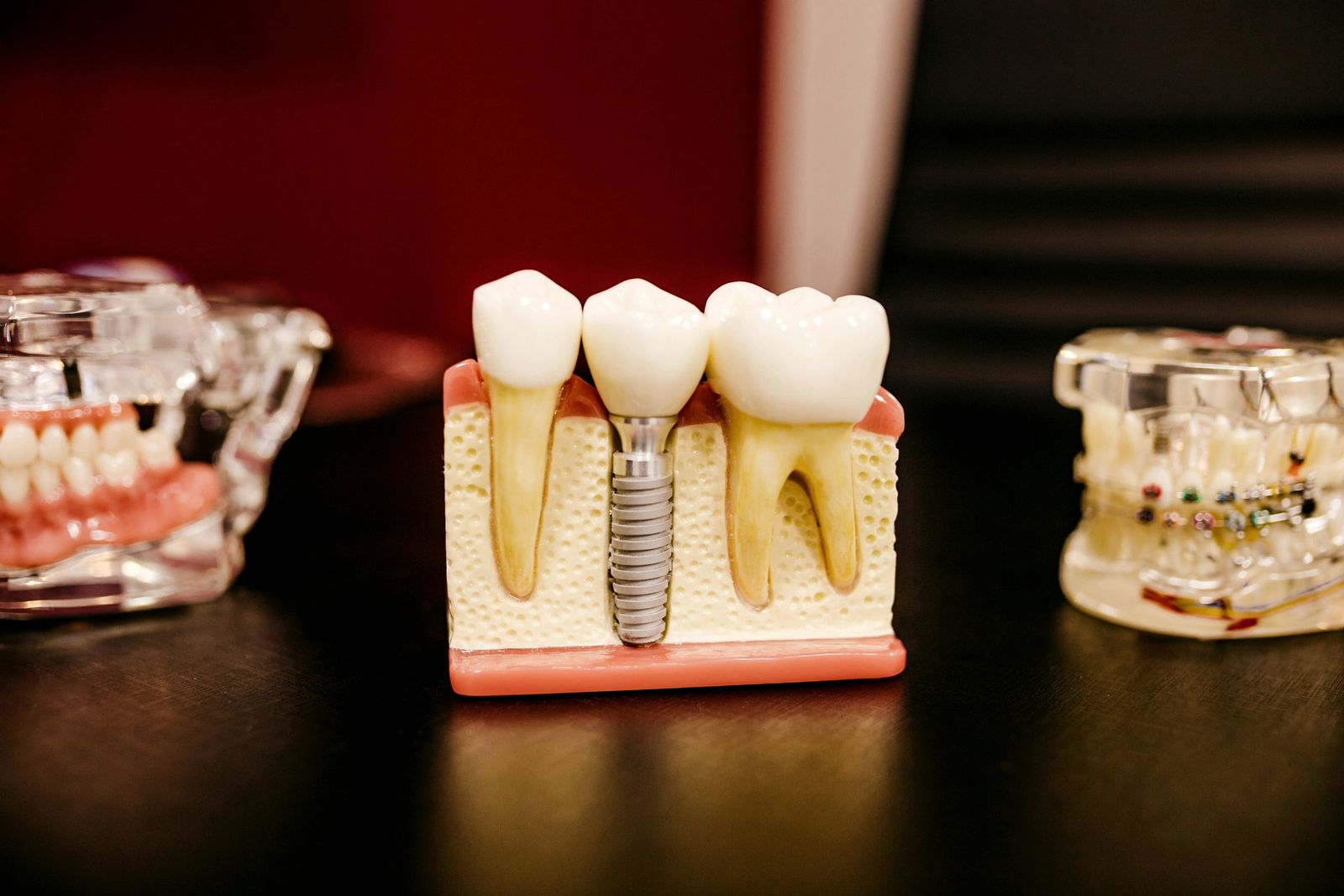 Dental implant model beside natural teeth